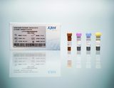 人CYP3A5基因分型检测试剂盒（荧光-PCR法）
